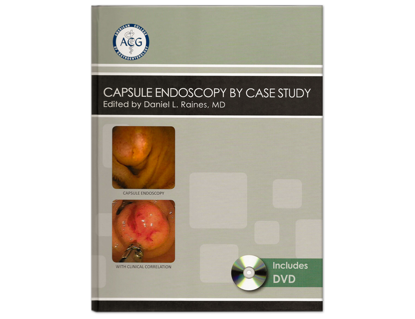 Capsule Endoscopy by Case Study - Medical