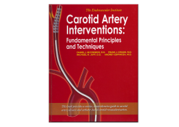 Carotid Artery Interventions - Medical