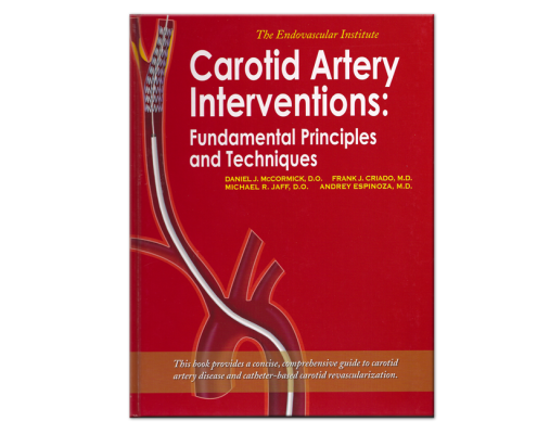 Carotid Artery Interventions - Medical