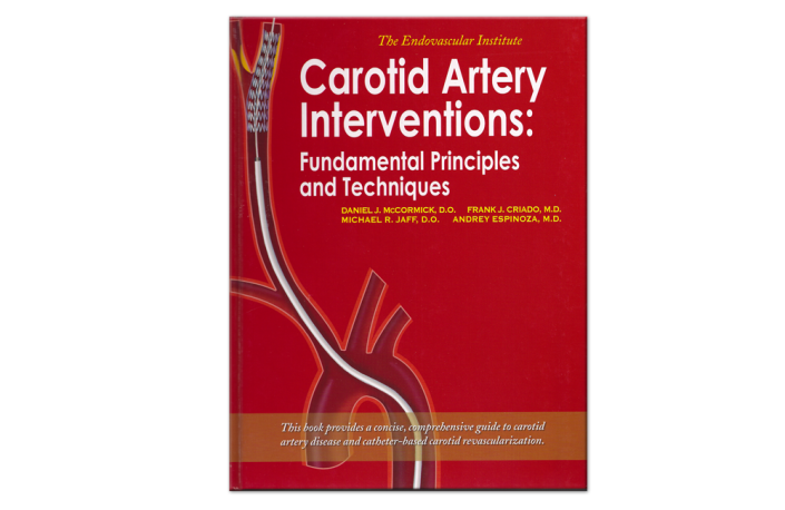 Carotid Artery Interventions - Medical