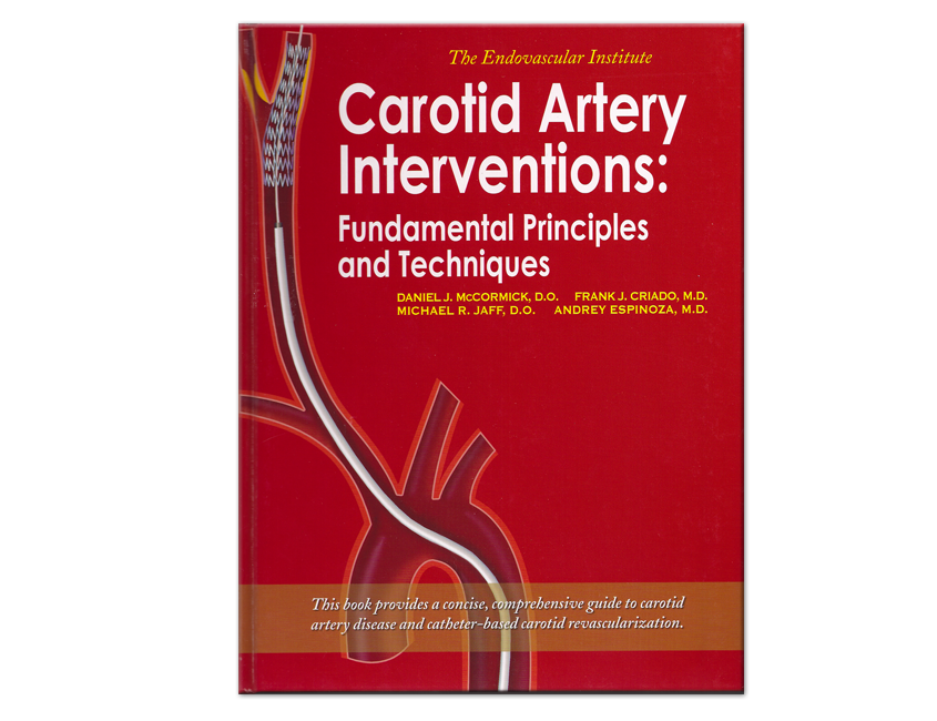 Carotid Artery Interventions - Medical